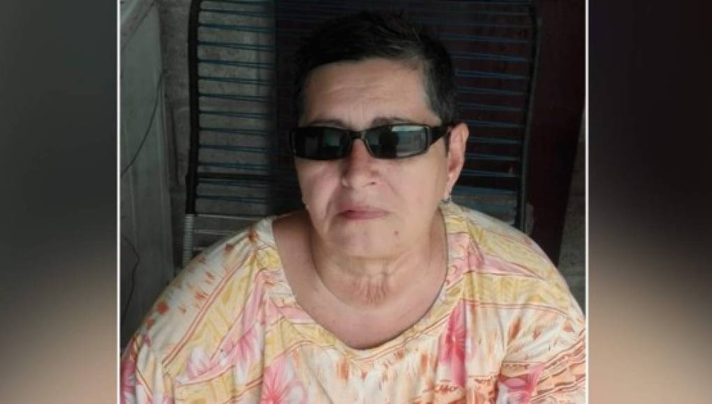 GoFundMe: hondureña pide ayuda para pagar cirugía que salvará su vista