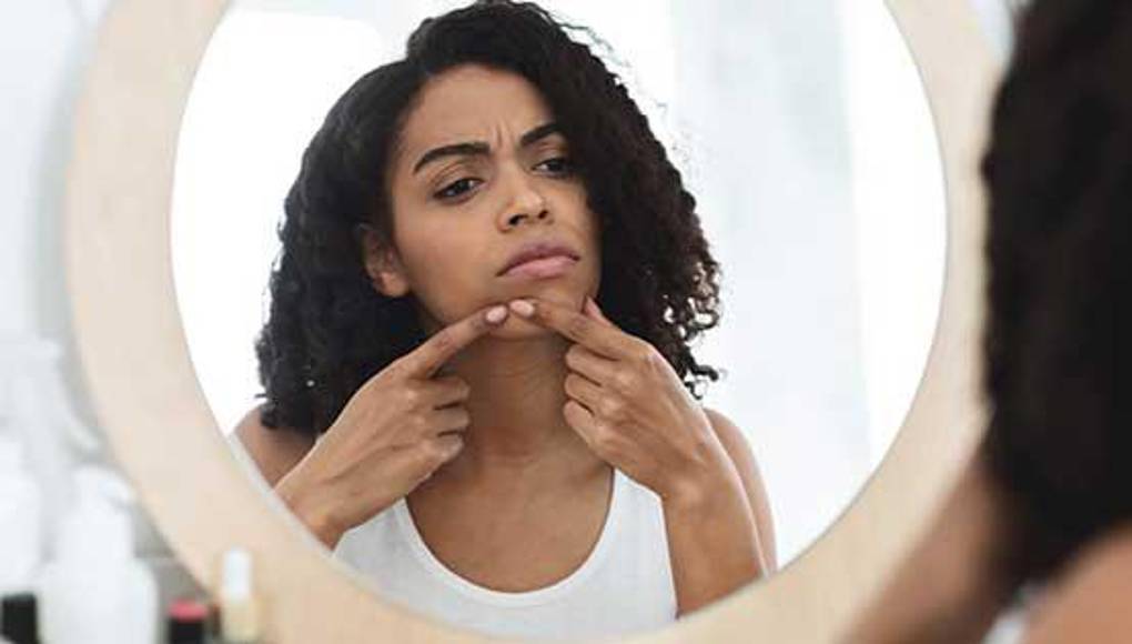Las personas de piel morena son más susceptibles a manchas de acné