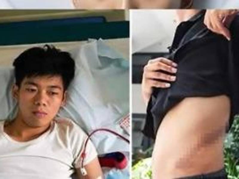 Video: Joven vende riñón para comprarse un IPhone