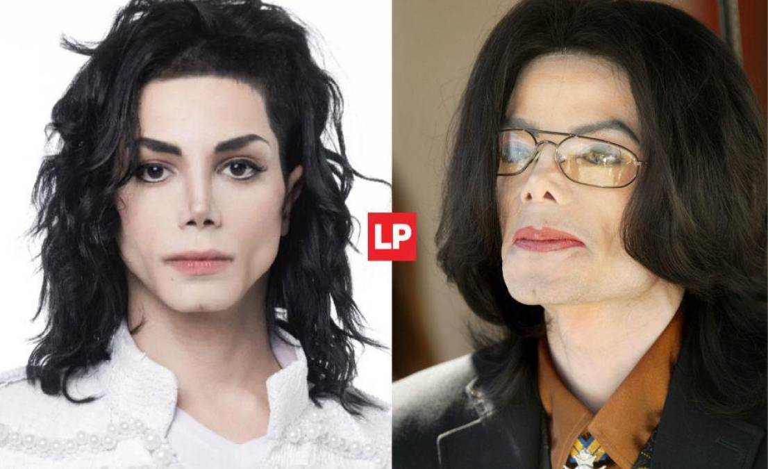 Leo Blanco es un joven de 26 años que es toda una celebridad, pues desde los 15 años ha intentado ser físicamente como Michael Jackson.