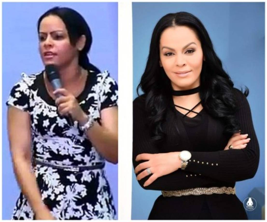 La pastora evangélica no se salva de las críticas, pues muchos internautas aseguran que Yesenia Then se ha realizado múltiples cirugías.