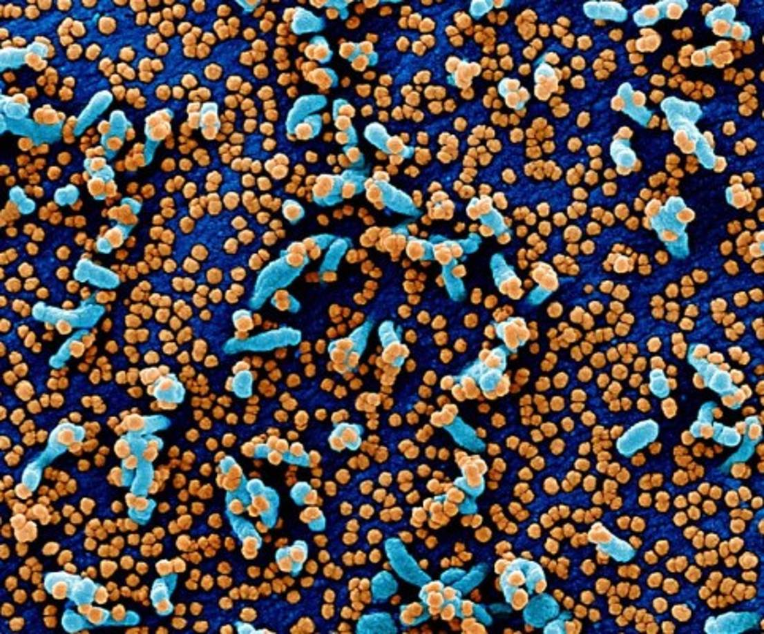 Para entonces, esas nuevas copias del virus ya estarán colonizando otras células y, eventualmente, llegarán a salir del portador. Un estornudo, una tos y el virus estará libre para buscar otro cuerpo.