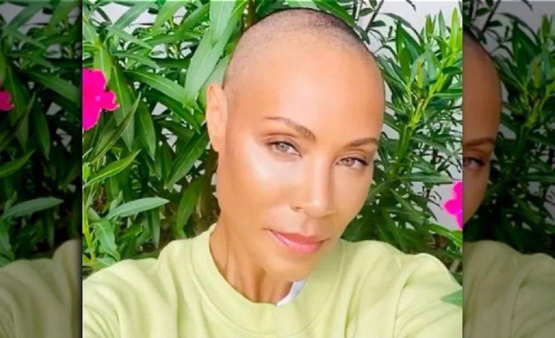 Jada Pinkett Smith: La dura batalla de la esposa de Will Smith contra la alopecia