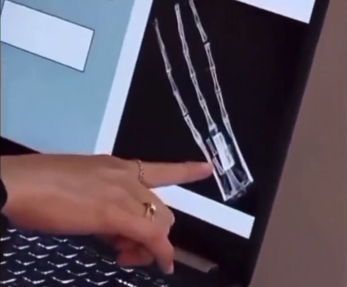 Maussan dijo que esos “cuerpos disecados” de “seres no humanos” fueron encontrados “entre las ciudades de Palpa y Nazca (Perú) en 2017”, y que según la UNAM, “quien realizó los análisis de carbono 14, estos seres tienen alrededor de 1.000 años de antigüedad”.