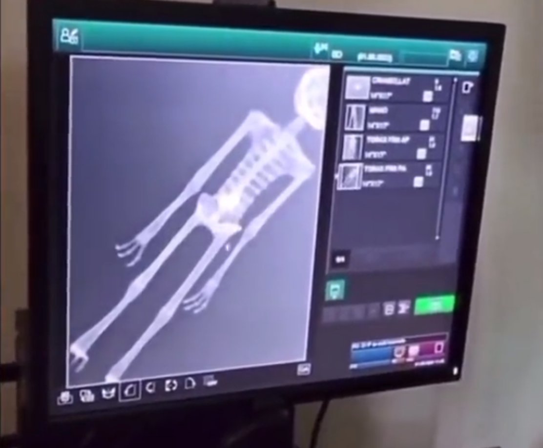 Sin embargo, el Instituto de Física de la UNAM negó categóricamente dichas afirmaciones, y aclaró que sus pruebas de carbono 14 solo determinan la antigüedad de las muestras, sin confirmar su origen.