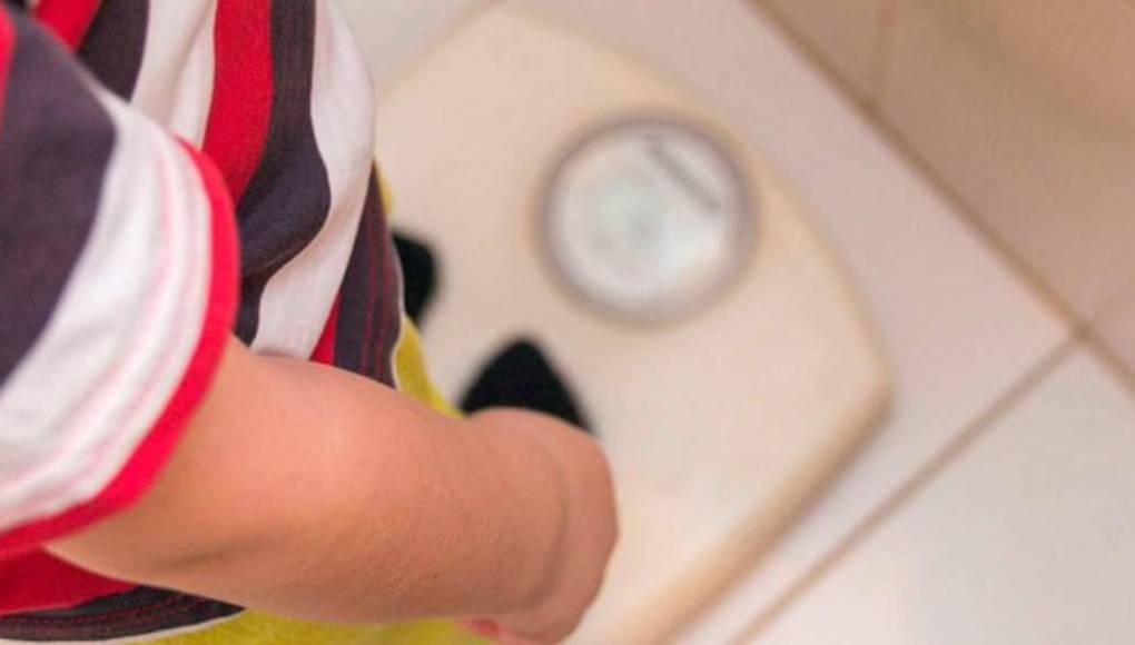 Vasos sanguíneos de los adolescentes obesos envejecen de forma prematura