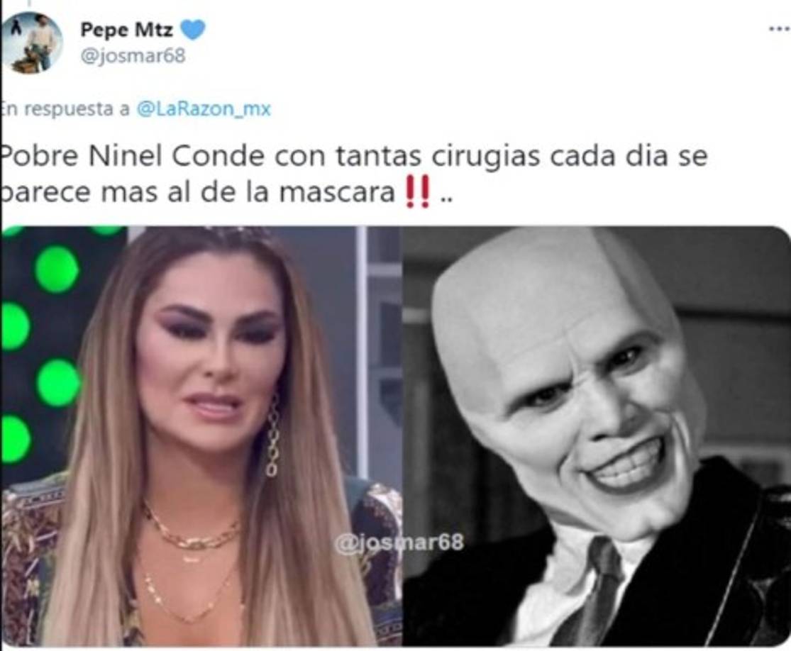 'El peor enemigo de Ninel es su cirujano plástico', agregó otro.