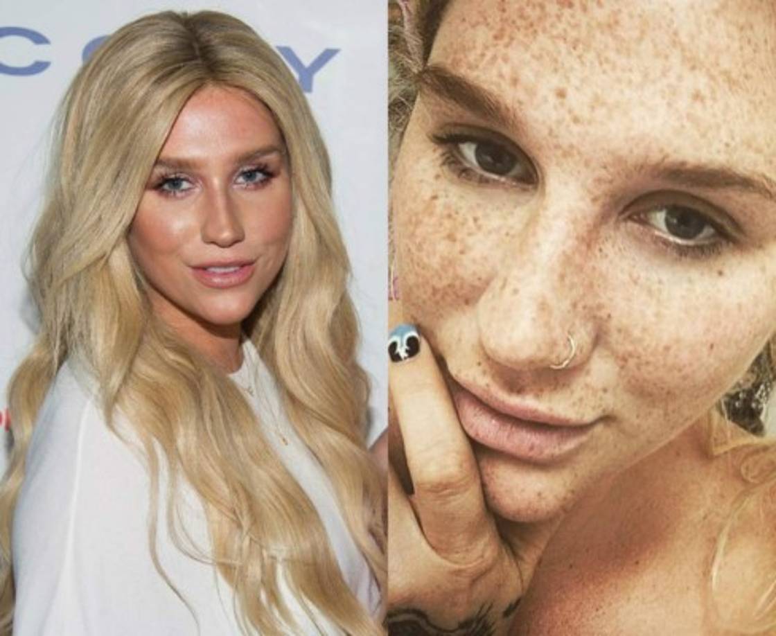 '¡Más pecas y menos Botox y rellenos! Eres una niña hermosa, ¡no necesitas nada! 😘', escribió uno de sus seguidores.<br/><br/>'¡Espera un momento, has estado escondiendo estas hermosas pecas todo este tiempo!', le dijo otro seguidor sorprendido al ver a Kesha al natural.