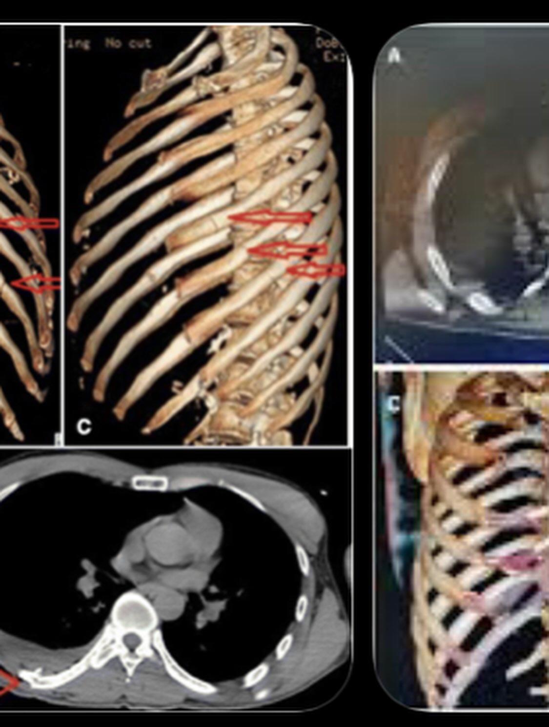 ¿En bancarrota? Estrella de El precio de la historia pide ayuda económica tras accidente