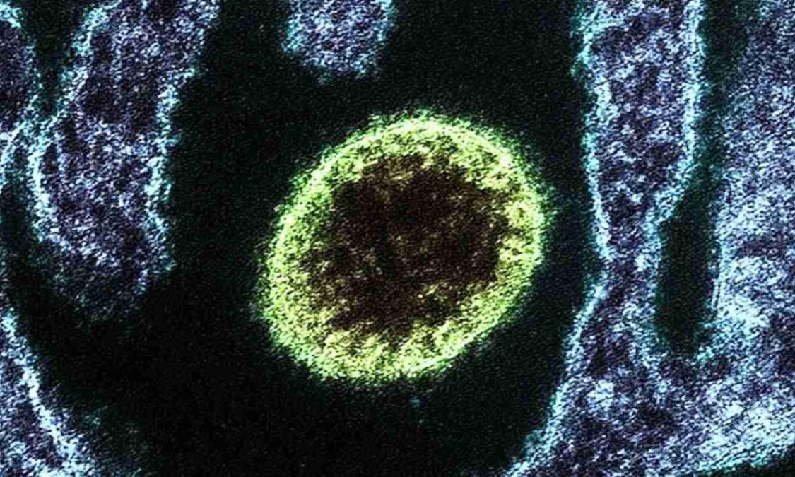 Nueva amenaza: ¿qué es el virus Nipah y cómo se transmite a los humanos?