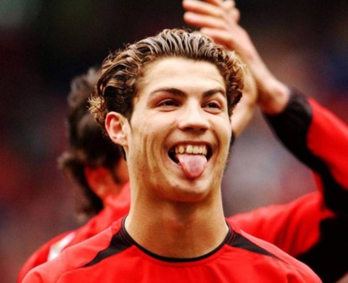 El portugués Cristiano Ronaldo recurrió a la ortodoncia: pasó de los brackets para alinear y mejorar su dentadura a una sonrisa perfecta.