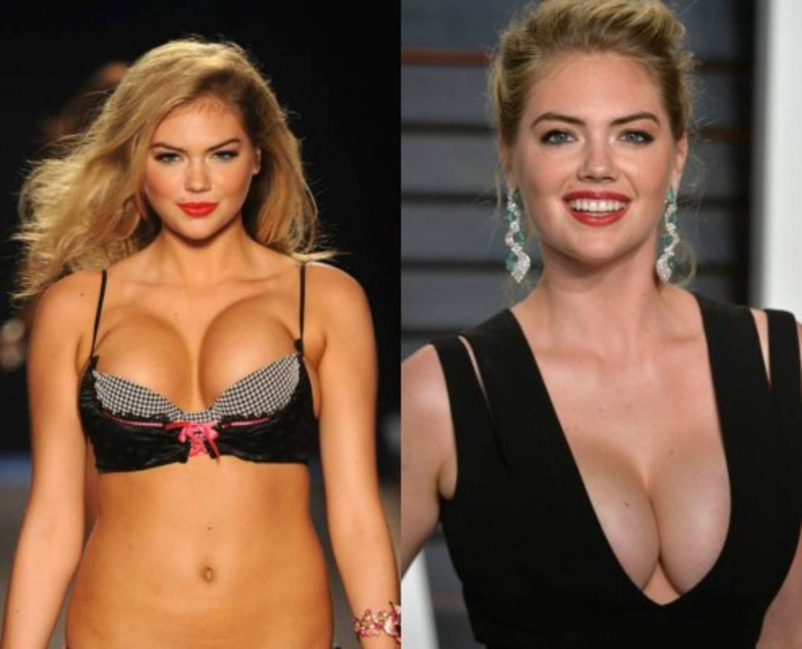 Kate Upton (34DD), dijo en una entrevista que le gustaría tener un escote menos voluptuoso, ya que está harta de que la atención se centre solo en este.<br/><br/>'Me encantaría tener unos senos menores cada día de mi vida; me gusta llevar tops sin sujetador o bikinis más pequeños. Cada día pienso que sería todo mucho más fácil, especialmente porque la gente no estaría todo el día hablando de ellos', dijo.
