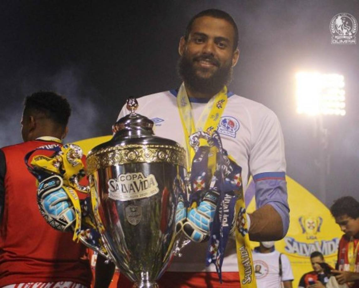 Edrick Menjívar con ofertas para salir del Olimpia. El portero, que tiene seis meses de contrato en el tricampeón, confirmó a Diario LA PRENSA que hay acercamientos con equipos centroamericanos y europeos. “Algunos equipos de Europa y Centroamérica han preguntado por mí, pero hasta los momentos solo son pláticas, por los momentos sigo en Olimpia, donde me encuentro muy bien“.