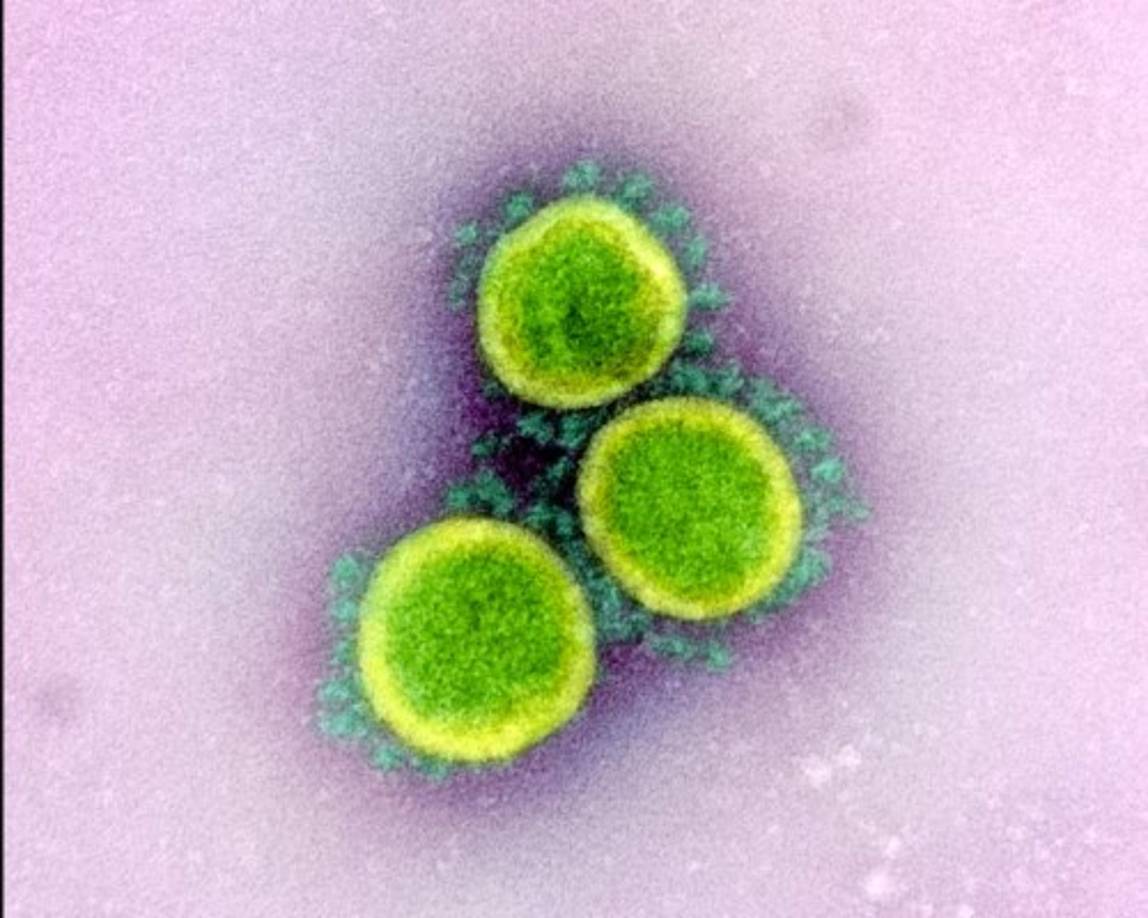 El COVID-19 ya ha contagiado a más de 1.9 millones de personas a nivel mundial y ha provocado el deceso de más de 125 mil personas.