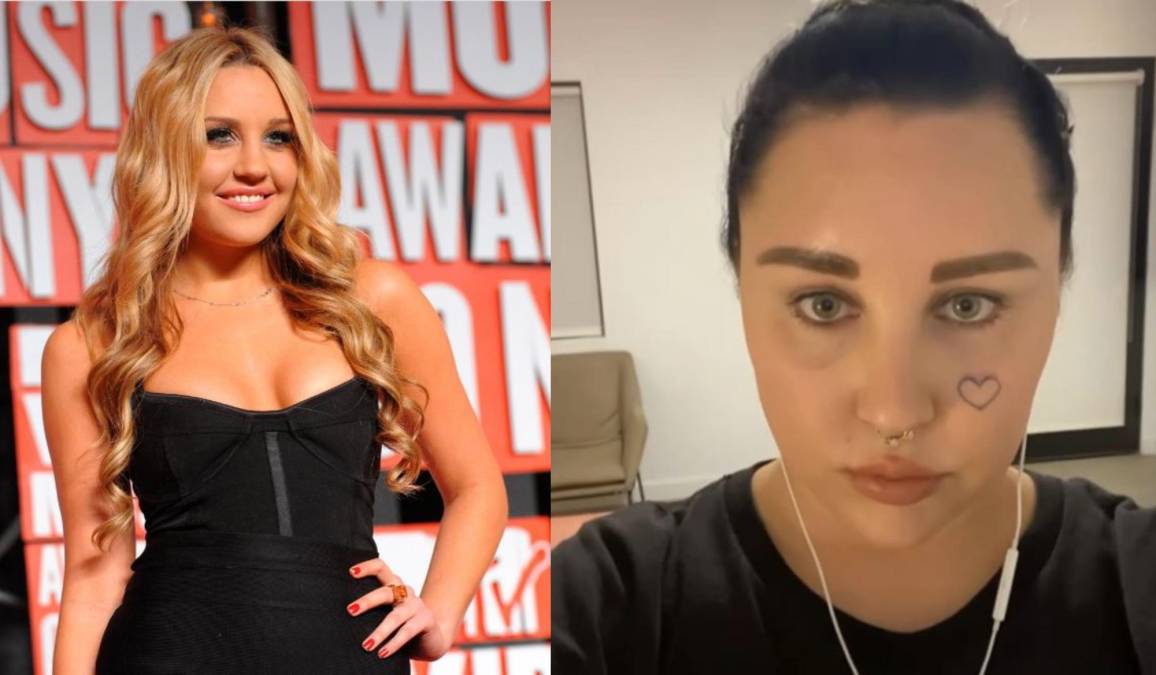 La actriz Amanda Bynes ha recibido apoyo en redes sociales por reconocer que necesitaba ayuda psiquiátrica y tomar las medidas necesarias para conseguirla en medio de un “episodio psicótico”. 