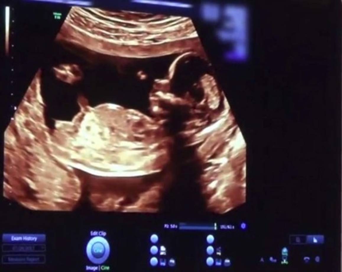 Kylie compartió con sus más de 100 millones de seguidores en Instagram una ecografía de su hija, de la que aún no ha revelado su nombre.