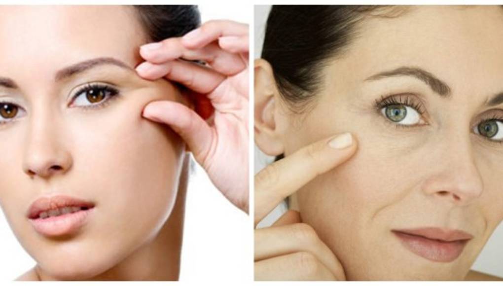 Vaselina y aceite para las patas de gallo