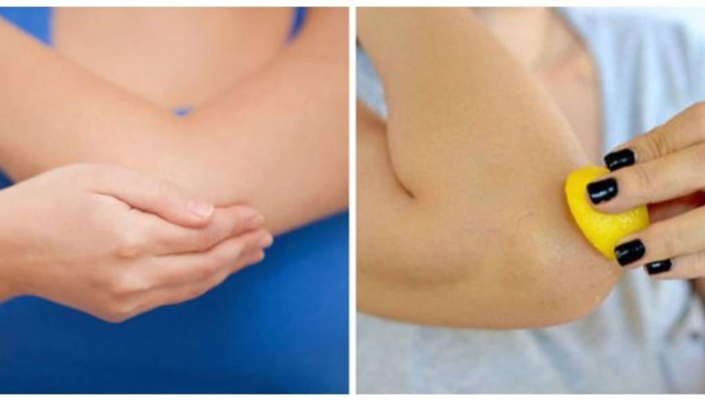 Aceite para los codos resecos