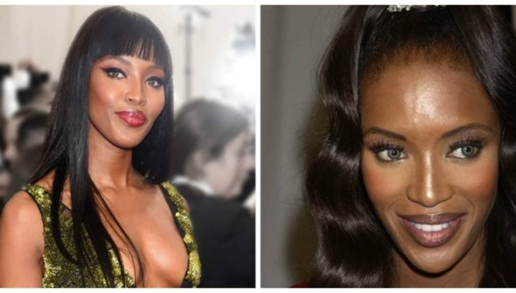 Naomi Campbell utiliza silla de ruedas por lesión