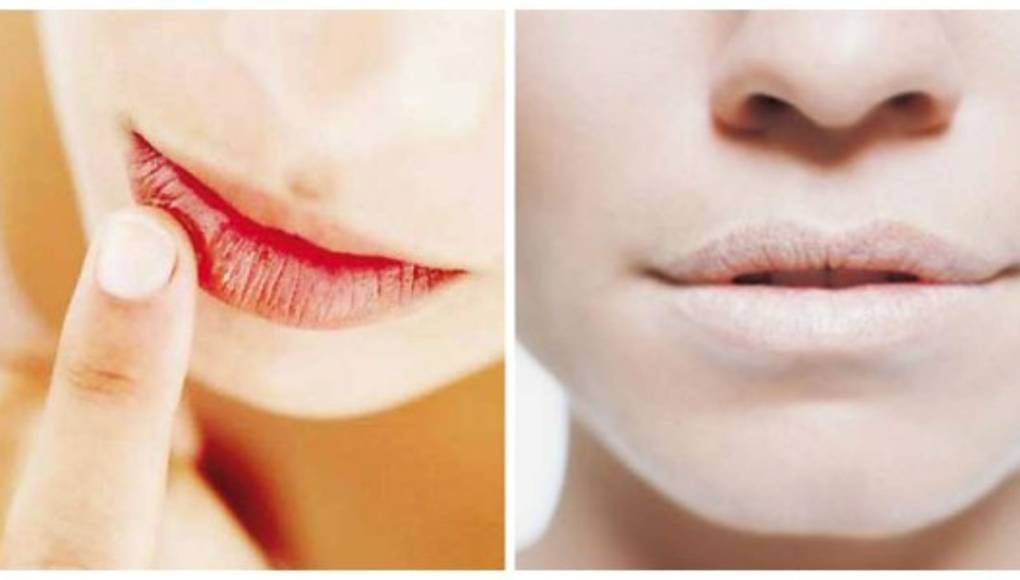 Aceite de mango para los labios secos y cortados