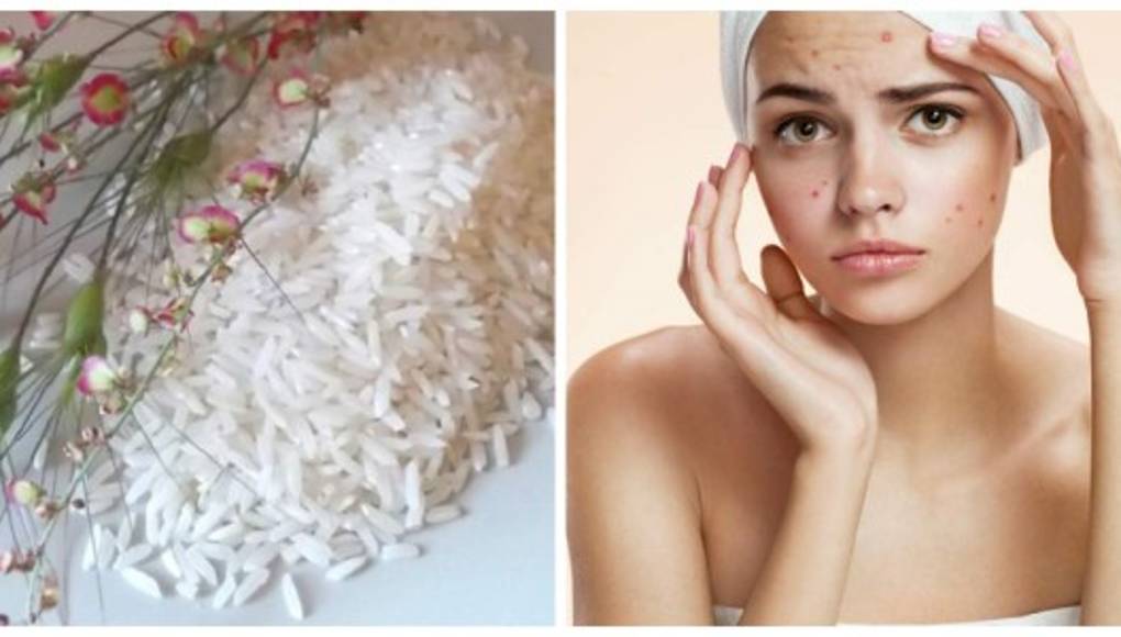 Arroz para el acné