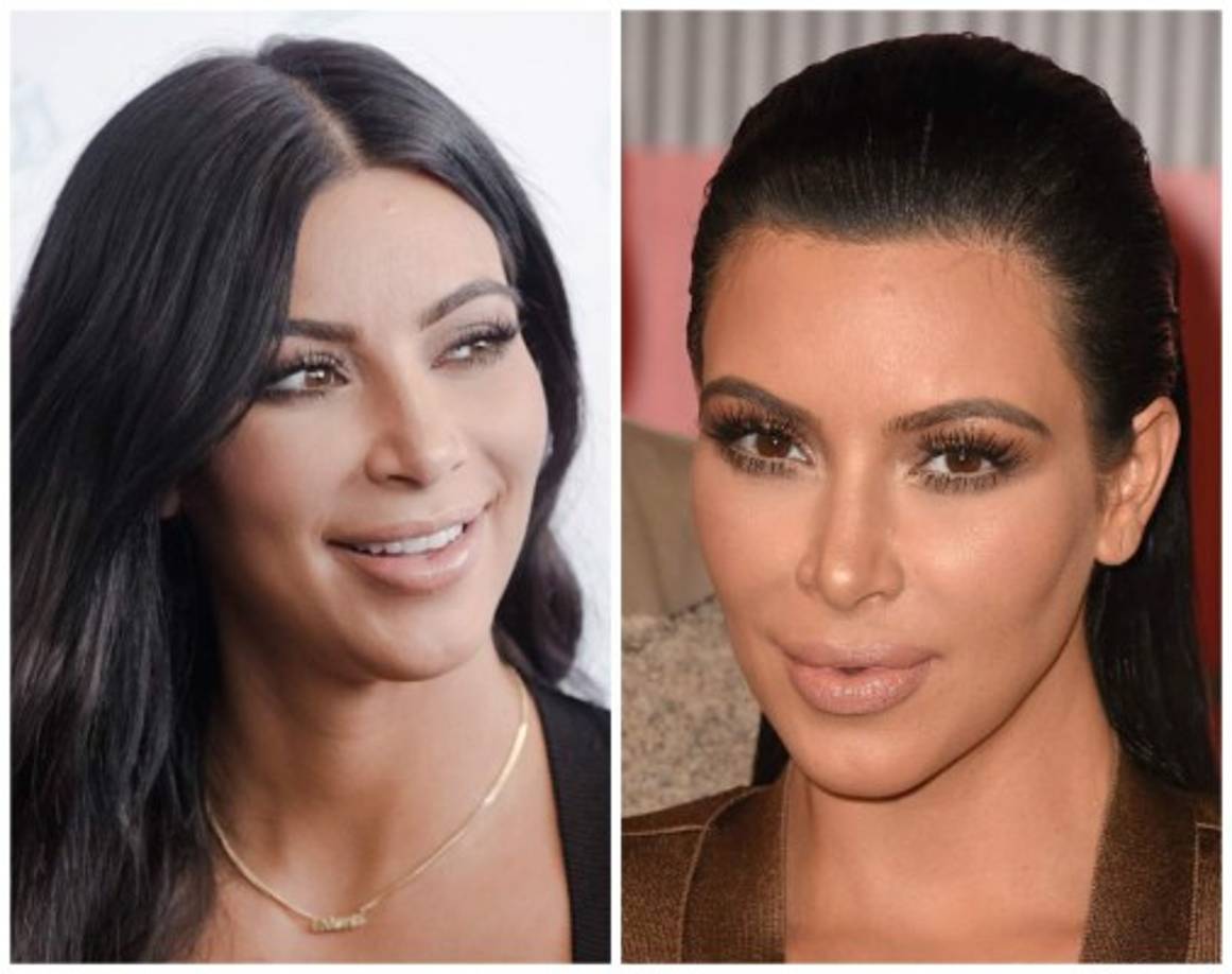 Ahora Kim Kardashian es una de las estrellas con los labios más carnosos.