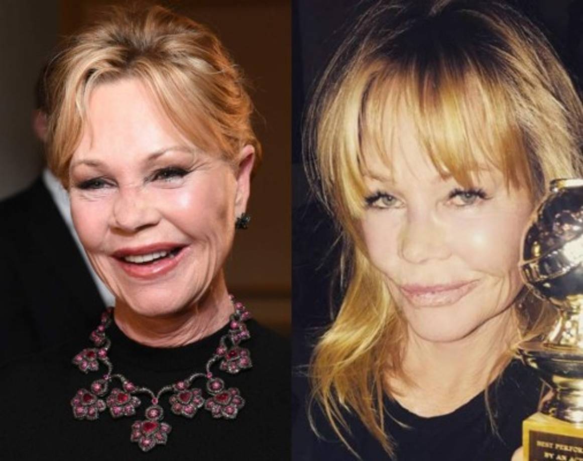 La actriz, que es conocida por sus múltiples cirugías, luce completamente diferente a como cuando inicio el año 2018.