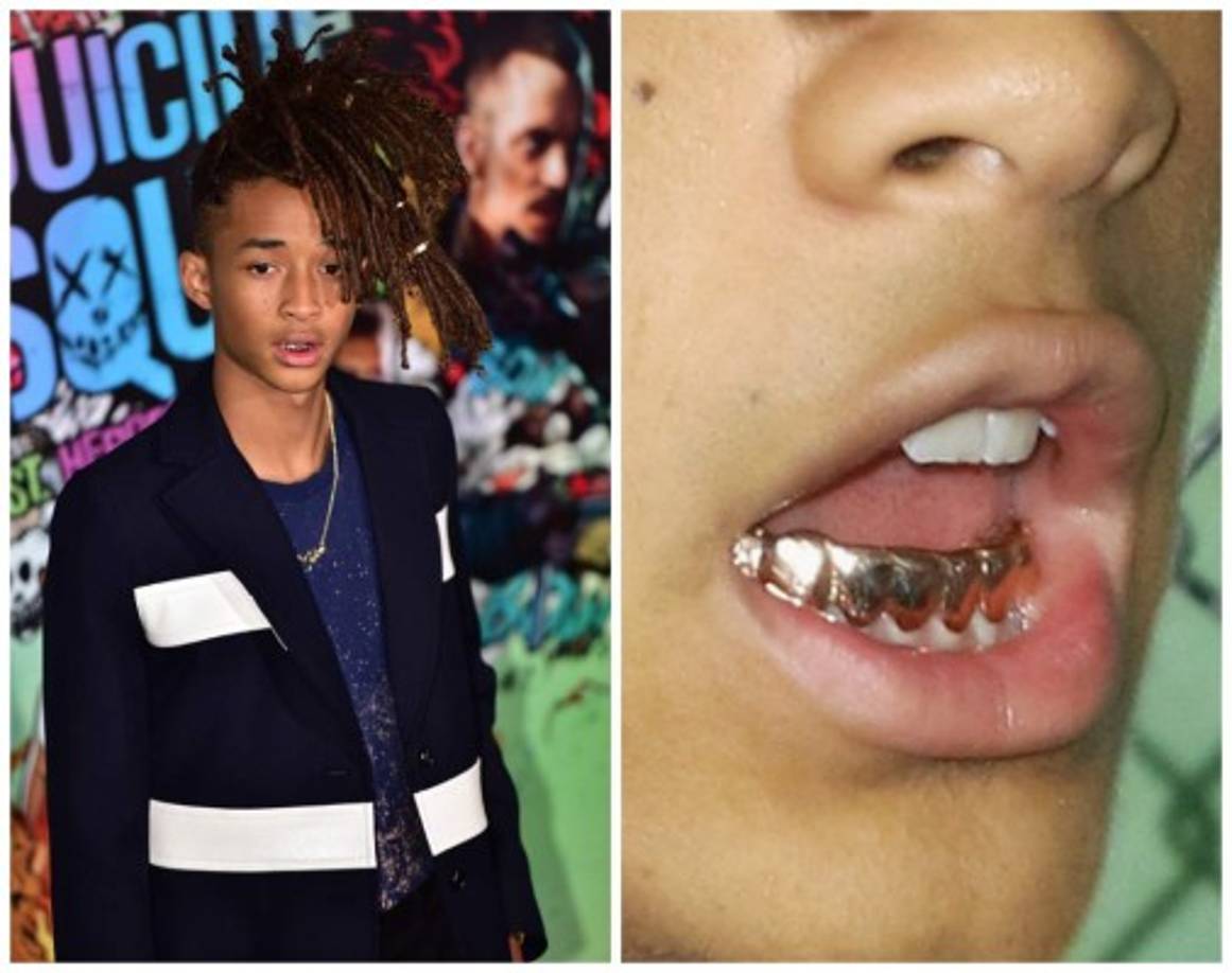 Los dientes de oro de Jaden Smith.