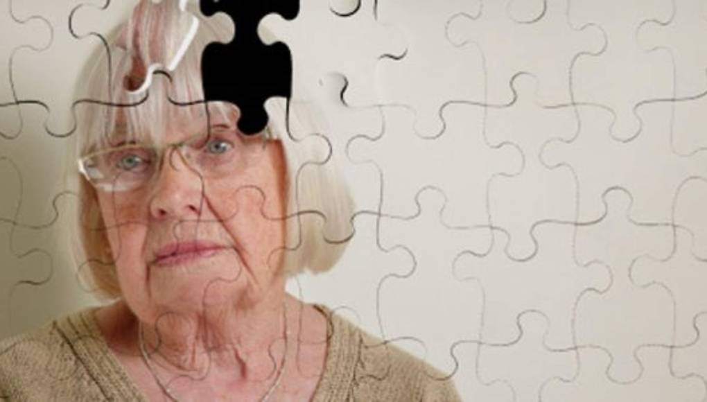 La carencia de vitamina D podría acelerar el declive mental