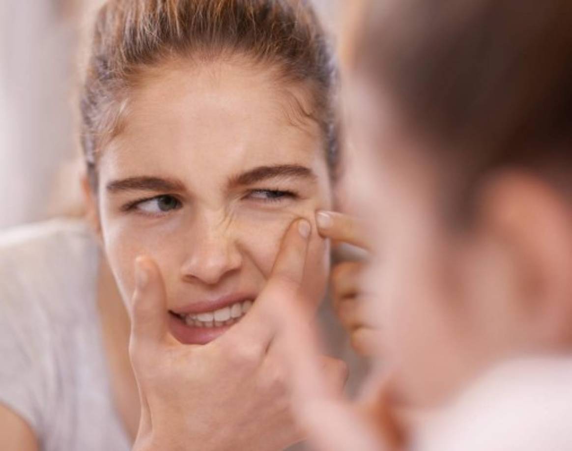 4. Eliminar espinillas<br/><br/>Debido a sus propriedades antisépticas, la piedra de alumbre consigue eliminar eficazmente las bacterias, promoviendo una limpieza adecuada de la piel. <br/><br/>Además de esto, como aumenta la tonicidad de la piel reduce los poros, dificultando la aparición de nuevas espinillas.