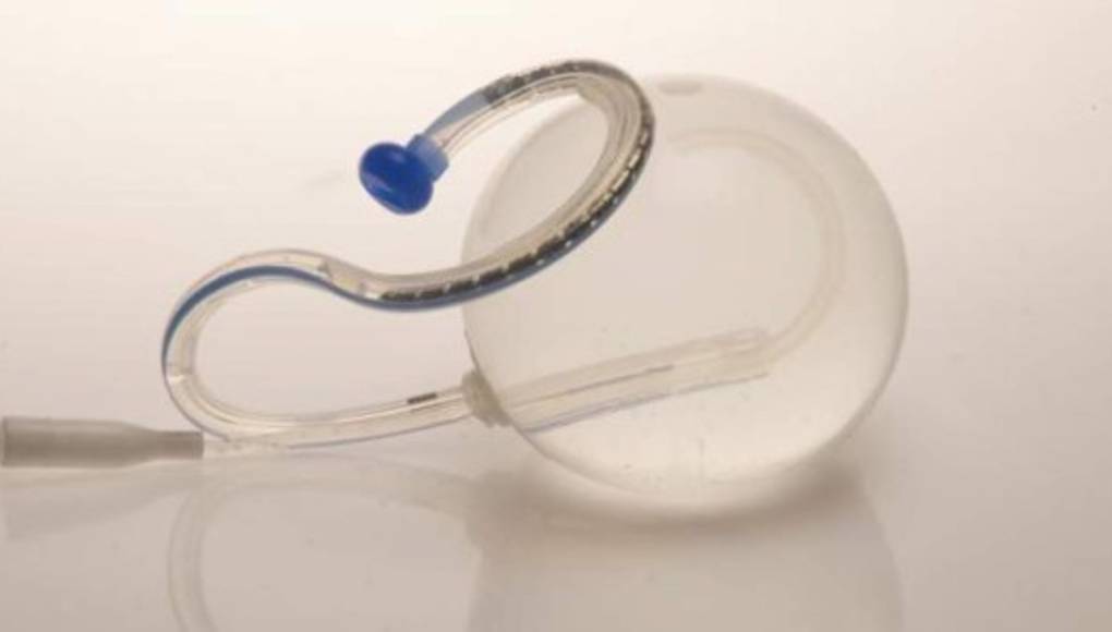 Un 'balón en pastilla' podría ser la nueva arma para perder peso