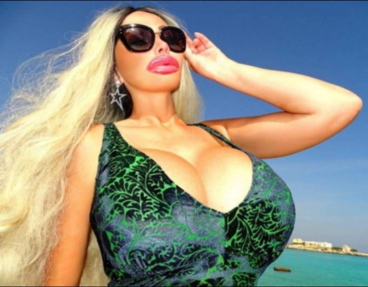 Victoria Wild se ha practicado una rinoplastía, implantes de labios, botox y tres mejoras en sus senos.