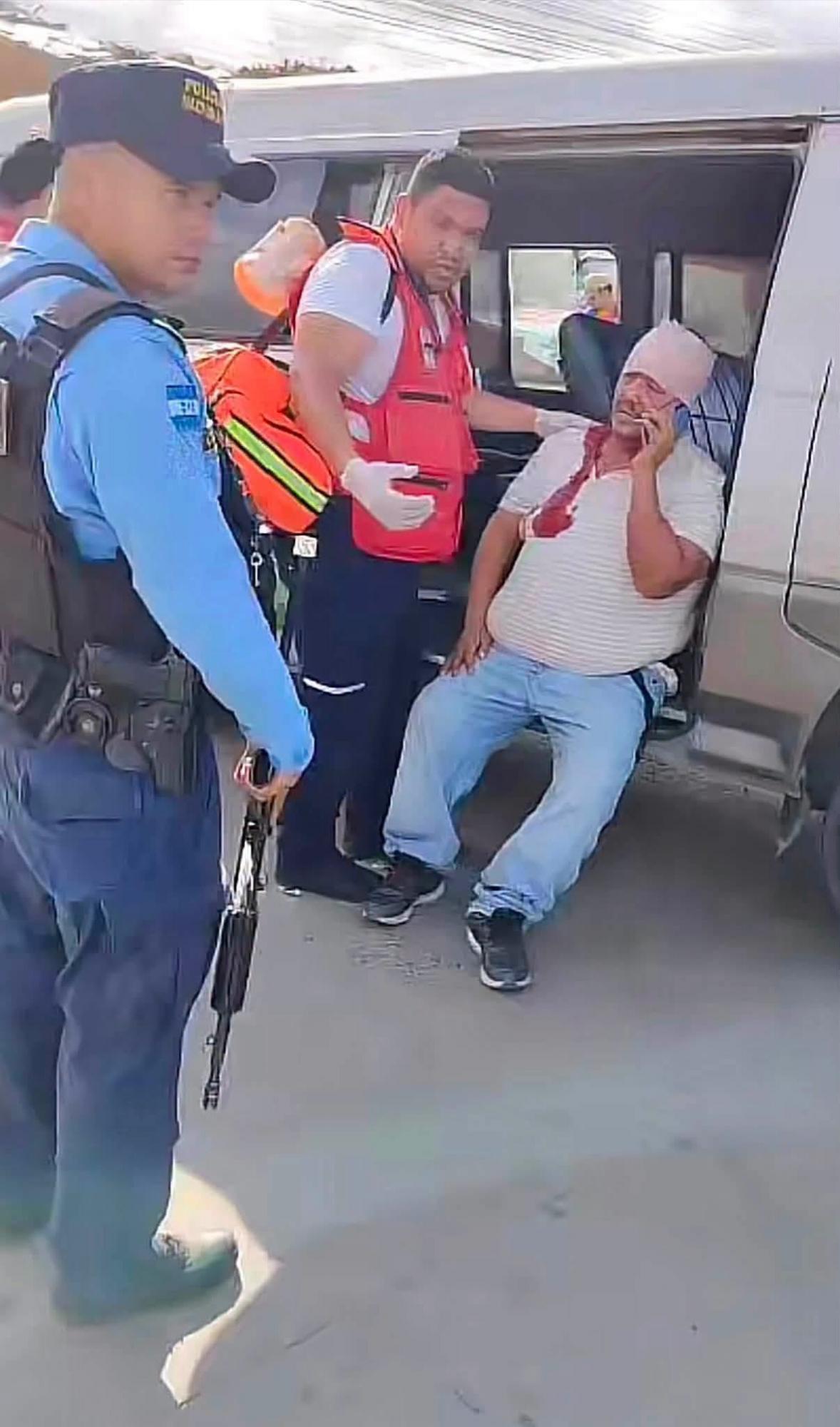 Múltiple choque provocado por bus rapidito deja varios heridos  en Choloma