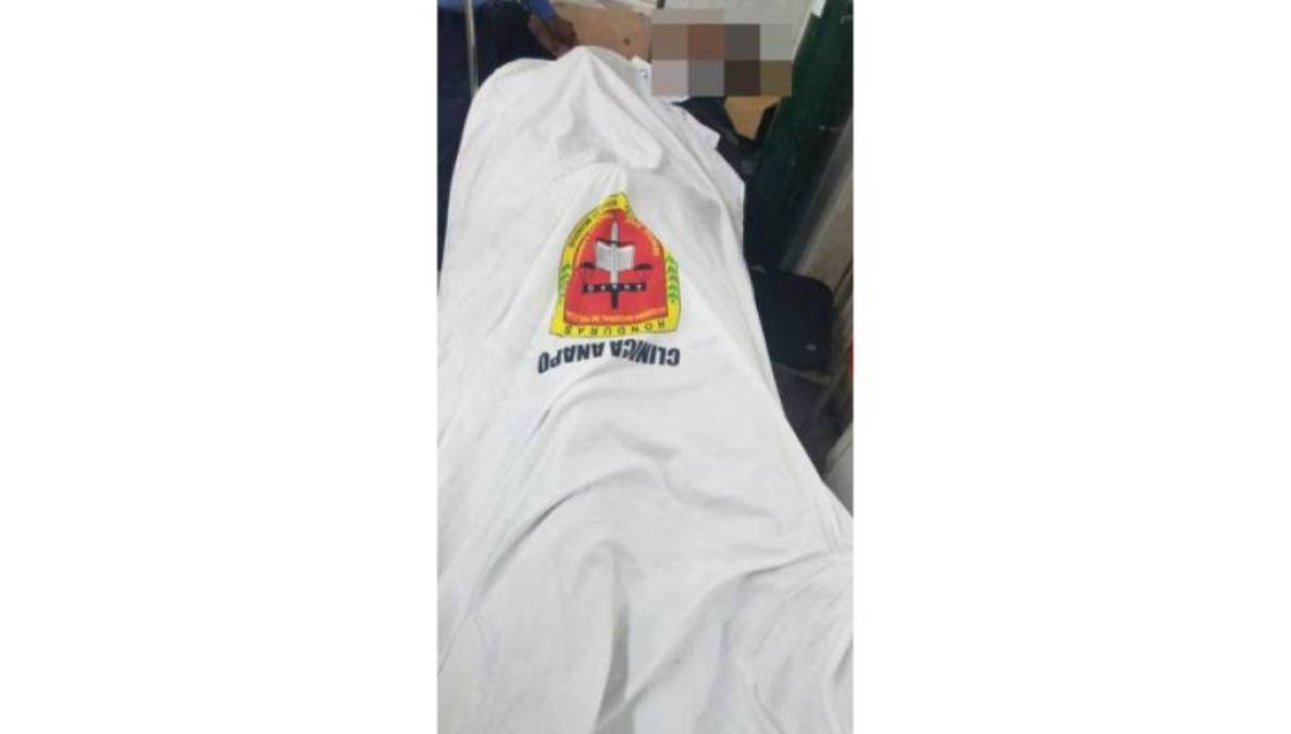 “Traen golpes en la cabeza”: Revelan detalles tras muertes de aspirantes en la ANAPO (FOTOS)