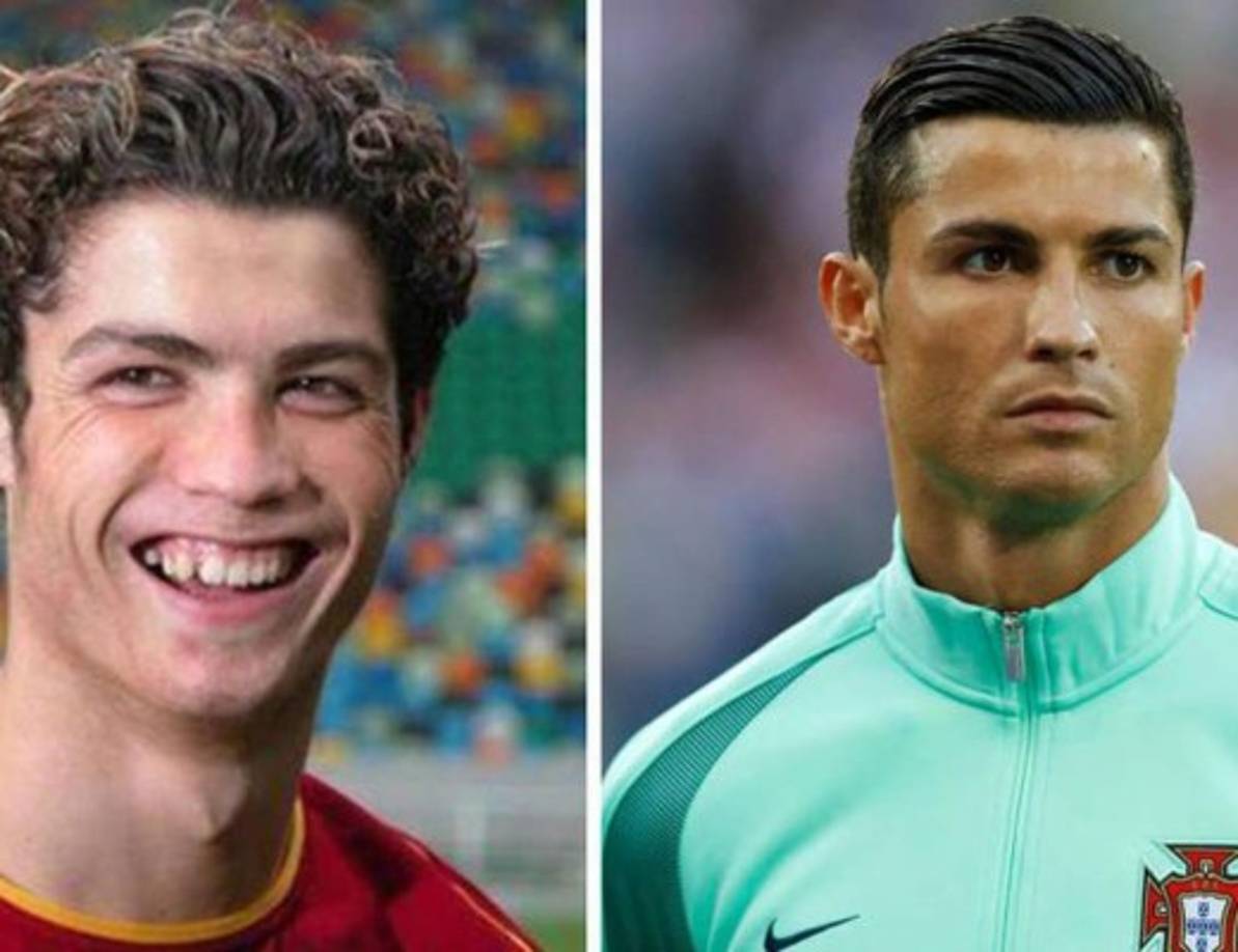 Cristiano Ronaldo: El portugués además de ser un gran jugador, también se ha desatacado por su gran apariencia, aunque no siempre lució así, pues hace algunos años, era una persona completamente diferente.