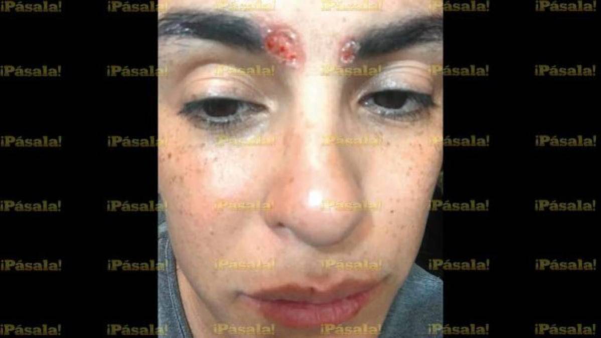 Varias fotos difundidas en distintos medios mexicanos, muestran las diferentes etapas que ha sufrido el rostro de la actriz.