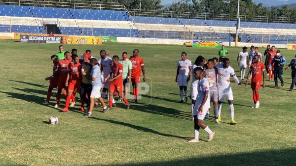 “Racismo no, racismo no”, se escuchó en la cancha que gritó Yustin Arboleda durante la pelea.