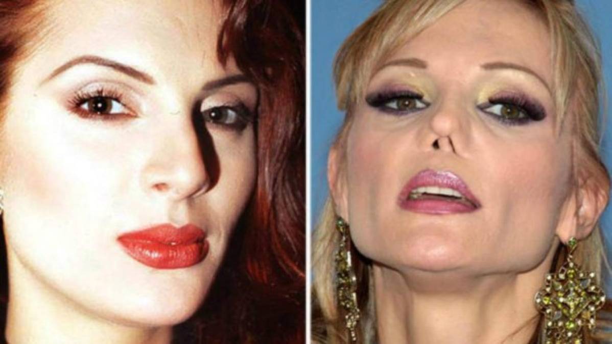 La actriz y modelo Carmen Campuzano es una de las celebridad que se desfiguró el rostro por su obsesión de lucir 'perfecta'.