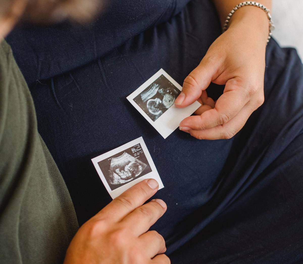 Crean estructuras similares a embrión humano sin esperma ni óvulos