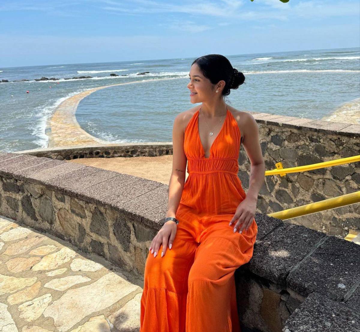 La Oruga revela la verdad sobre sus cirugías y cuánto genera por su contenido