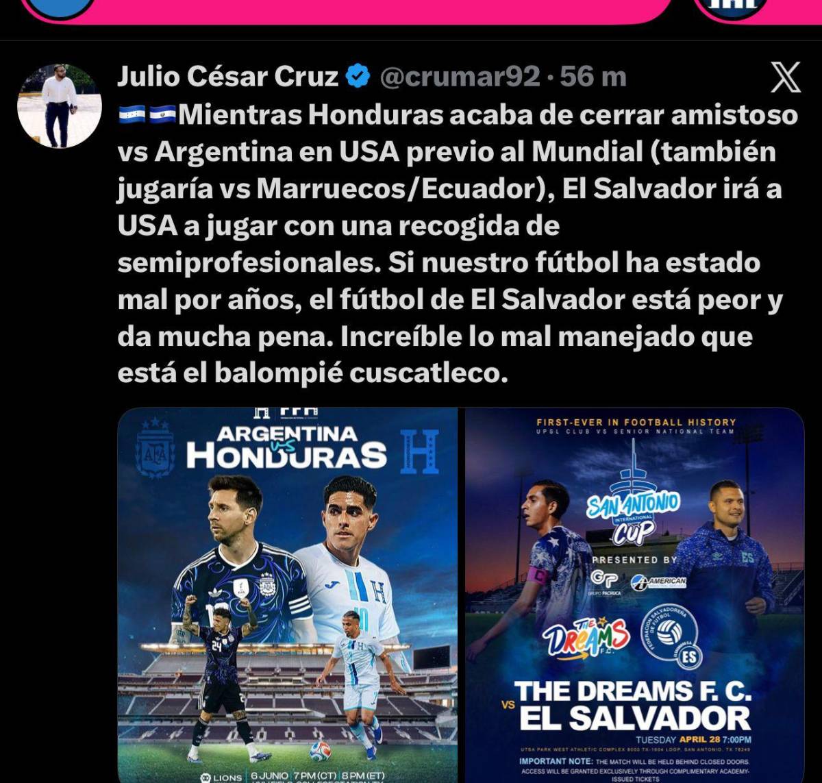 Esto dicen en Argentina por el amistoso vs Honduras; lanzan advertencia