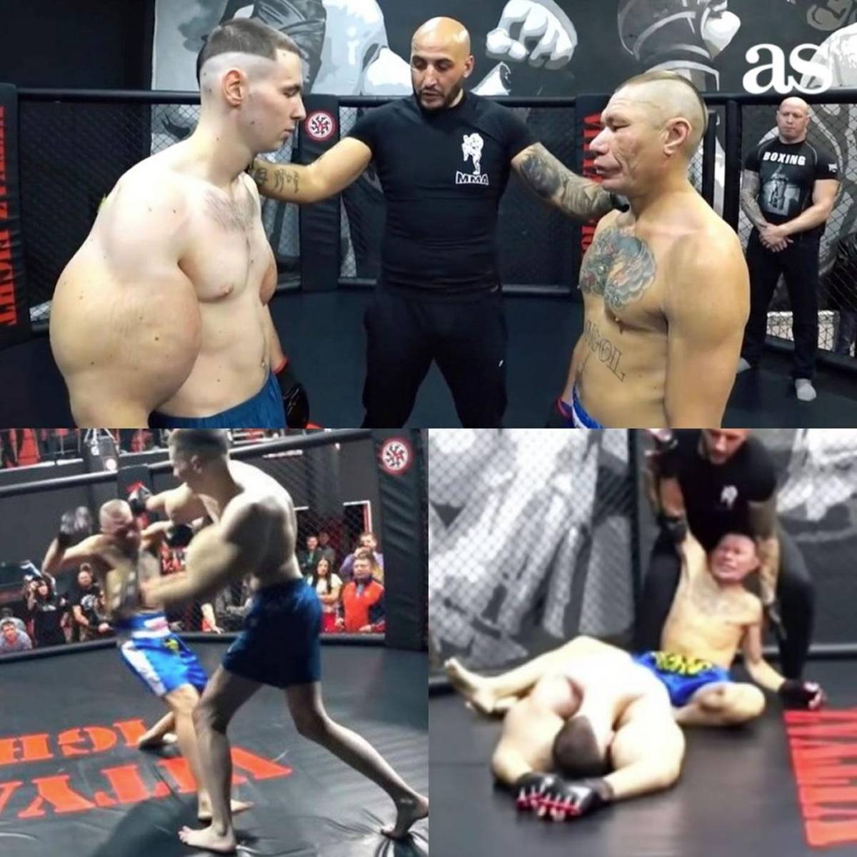 Deportista 'Popeye ruso' hace dramática confesión: podría perder los dos brazos