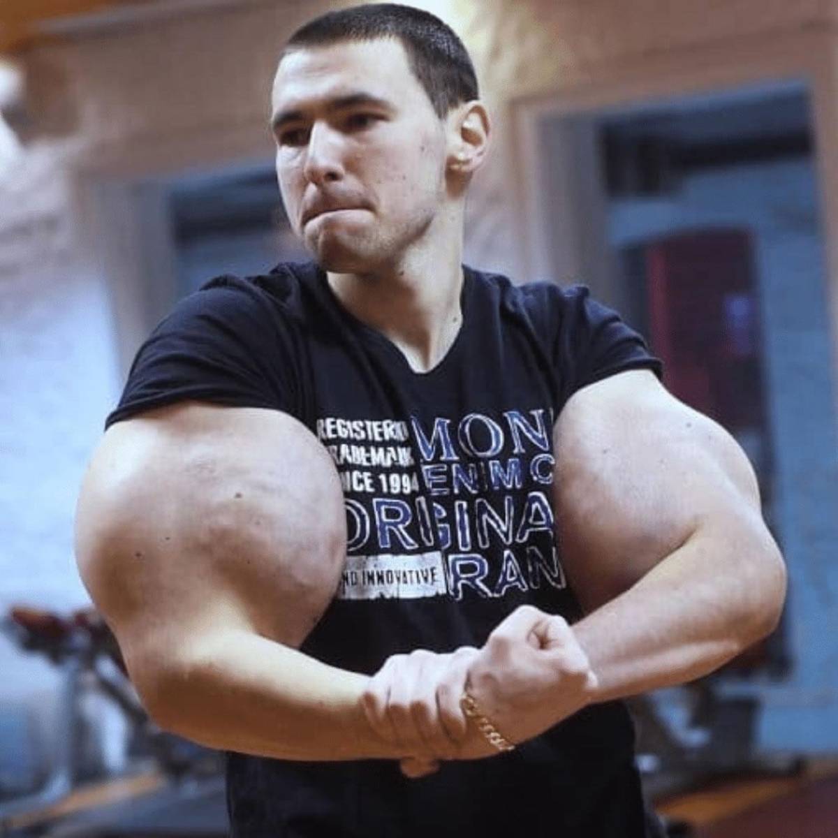 Deportista 'Popeye ruso' hace dramática confesión: podría perder los dos brazos