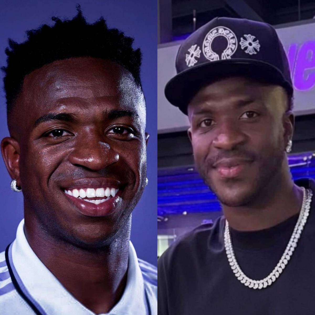 Vinicius con nuevo rostro: se operó y sorprende con brutal cambio tras el Mundial