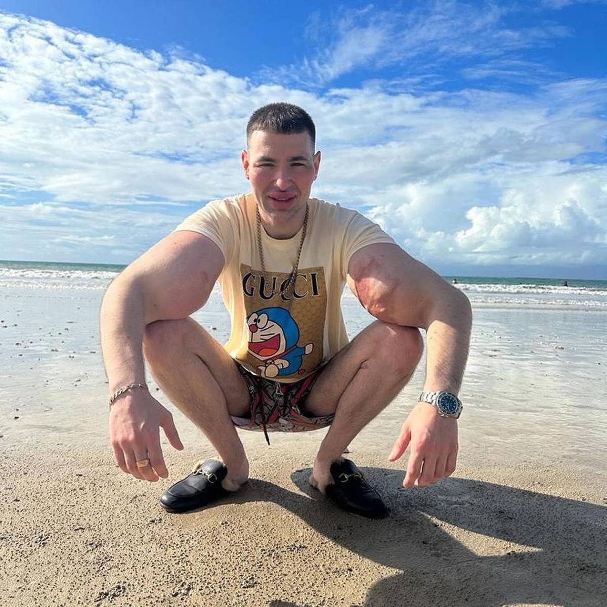 Deportista 'Popeye ruso' hace dramática confesión: podría perder los dos brazos