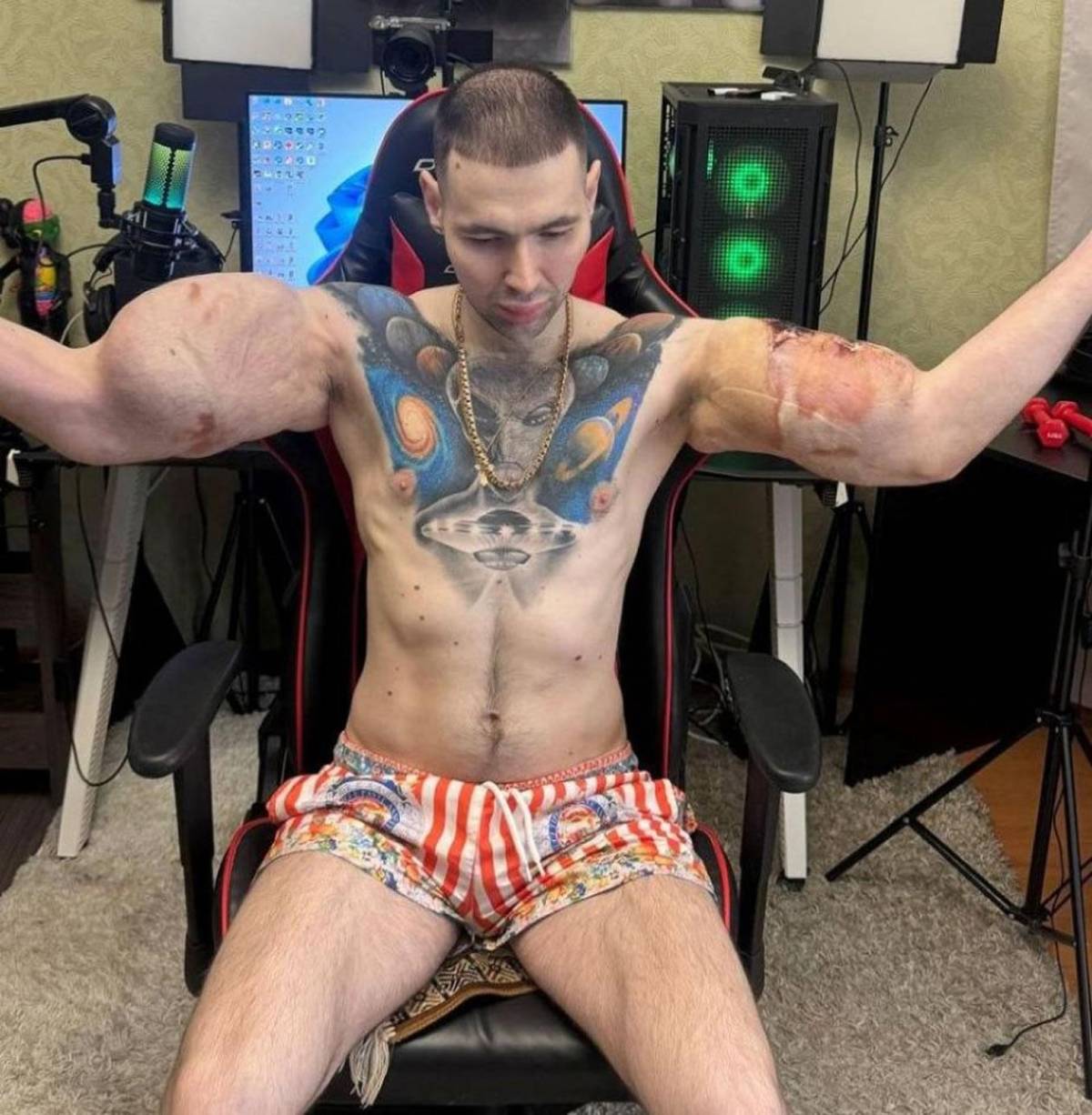 Deportista 'Popeye ruso' hace dramática confesión: podría perder los dos brazos