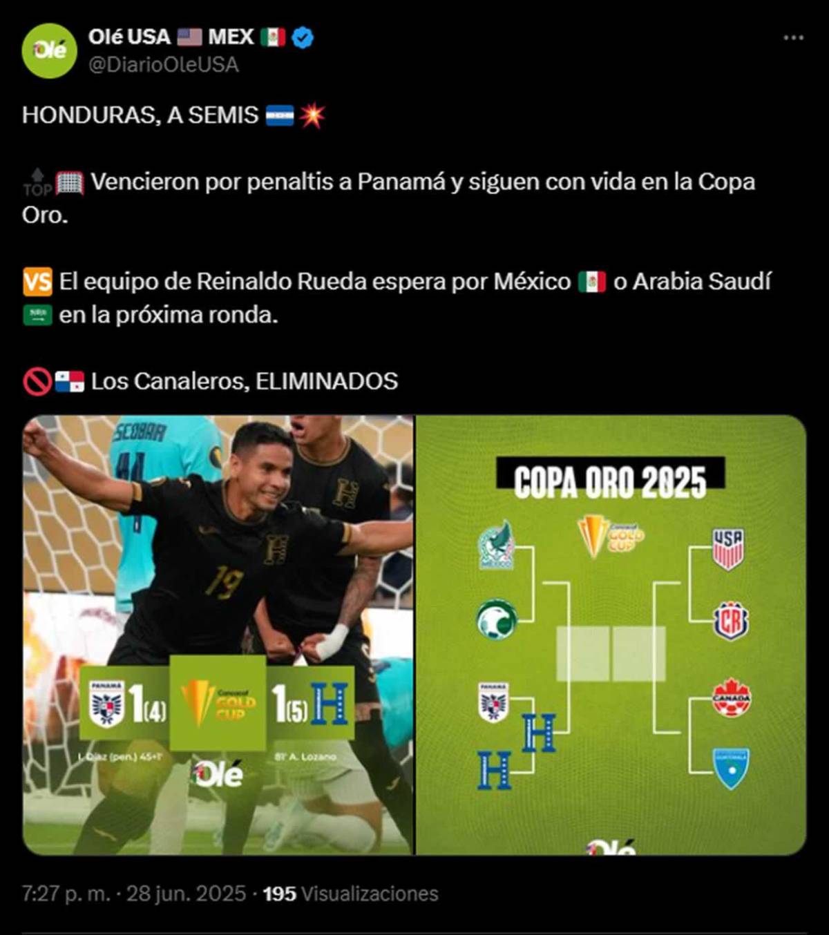 'ChepeBomba' sufre por Panamá y famoso sorprende: esto dicen de clasificación de Honduras