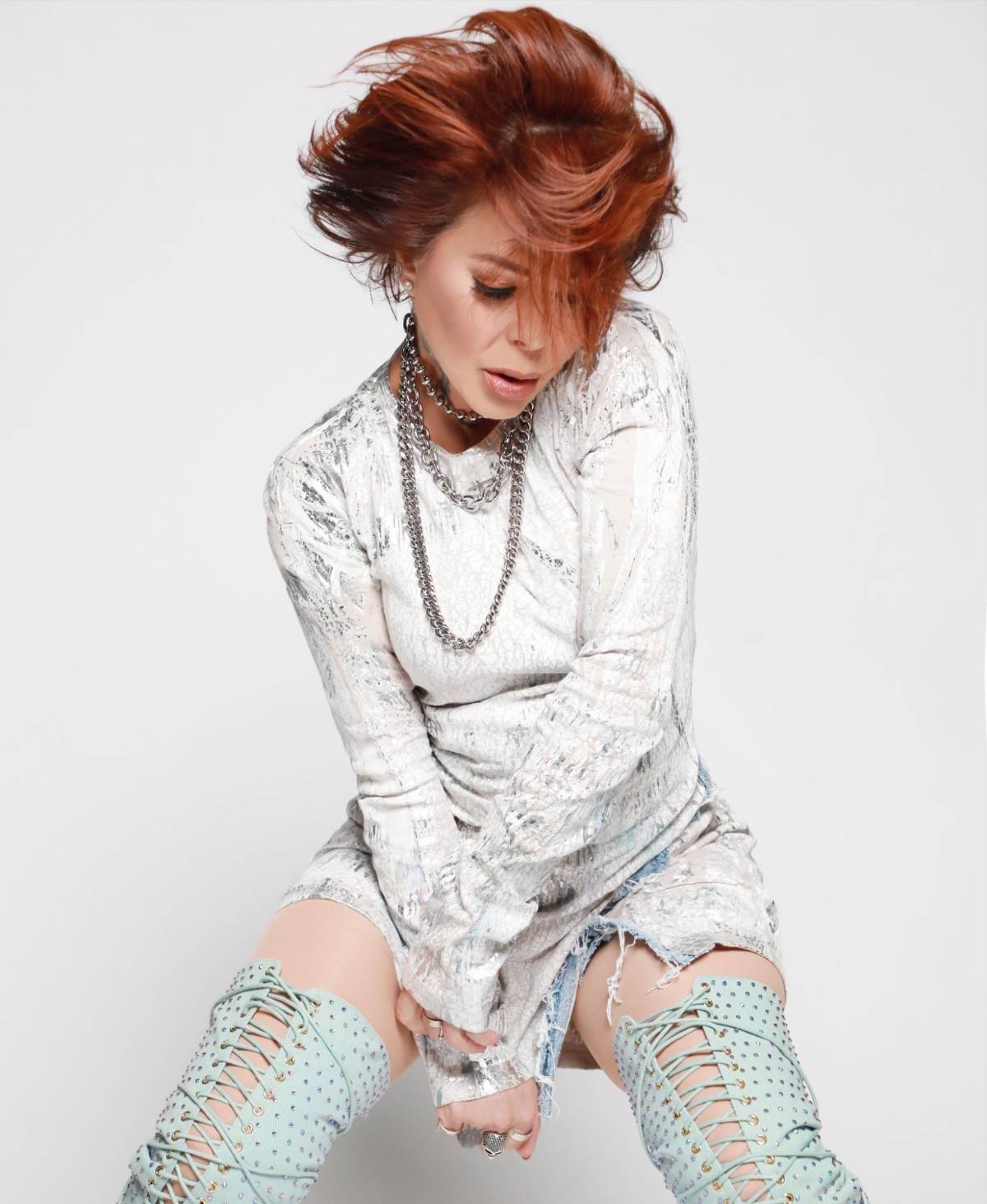 Alejandra Guzmán es operada de la columna vertebral, ¿cuál es su estado de salud?