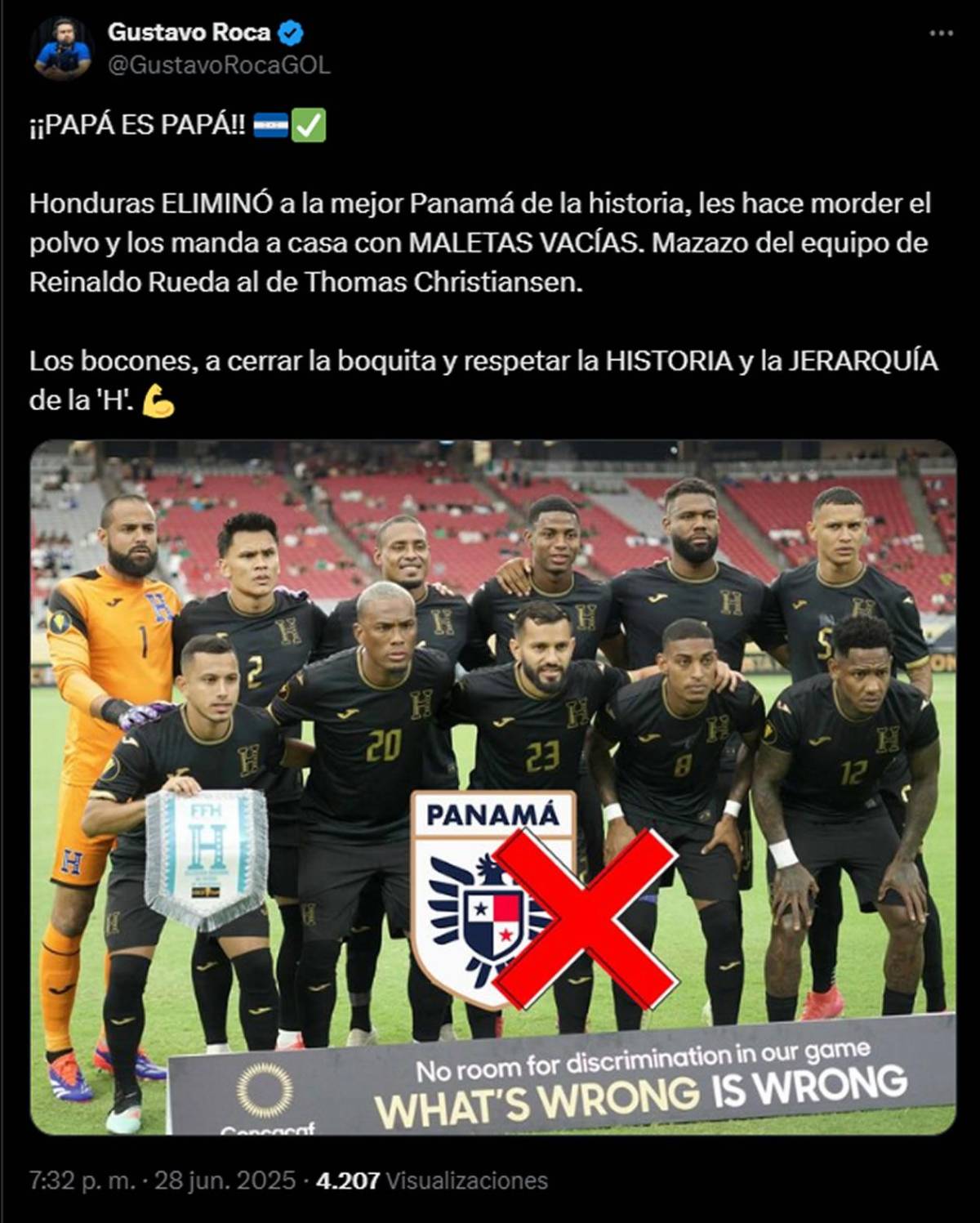 'ChepeBomba' sufre por Panamá y famoso sorprende: esto dicen de clasificación de Honduras