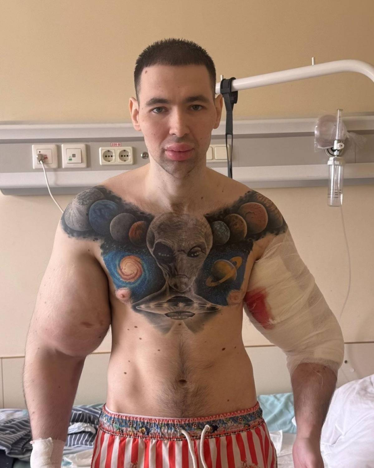 Deportista 'Popeye ruso' hace dramática confesión: podría perder los dos brazos